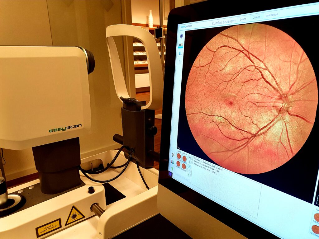 Für Ihre Augengesundheit: Netzhaut-Screening per Easy-Scan bei Optiko in Hamburg City